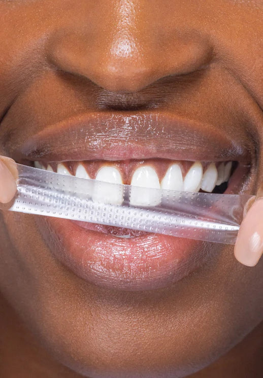 đ„Jetzt 40% RabattđPAP+ Whitening Strips â Strahlend WeiĂe ZĂ€hne mit Einfachen Streifen