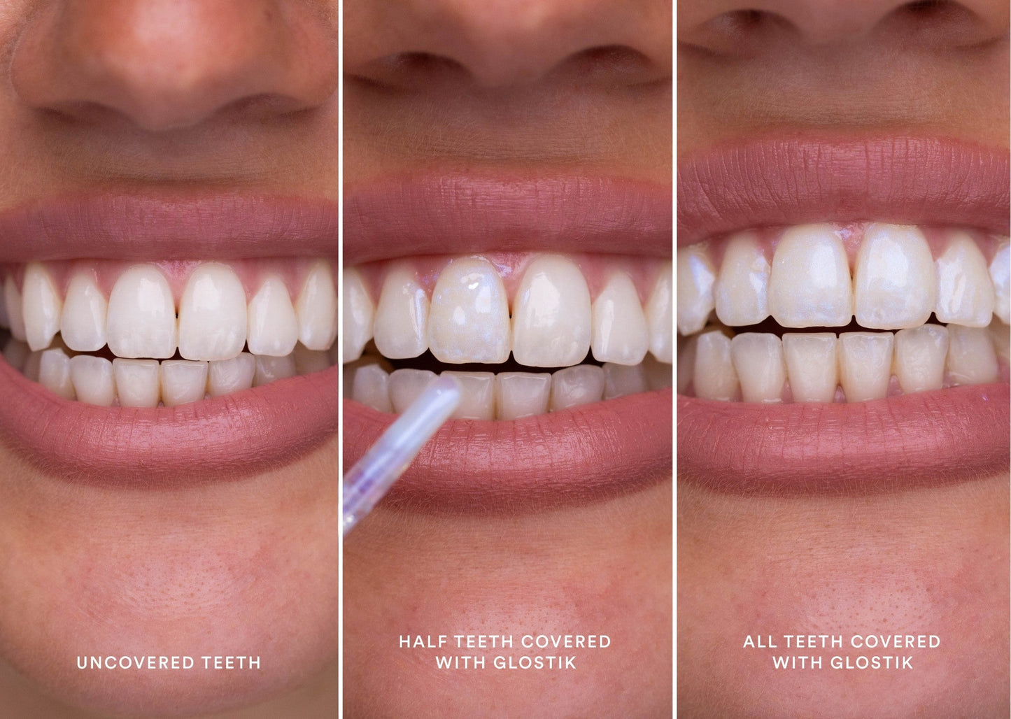 🔥Jetzt 40% Rabatt🎁 - Glostik PAP+ Reihe Tooth Gloss – 🦷Strahlend Weiße Zähne in Minuten! 🌿Natürlich & Effektiv-Perfektes Lächeln mit Glanz,Zahnglanz Revolution für Dich。
