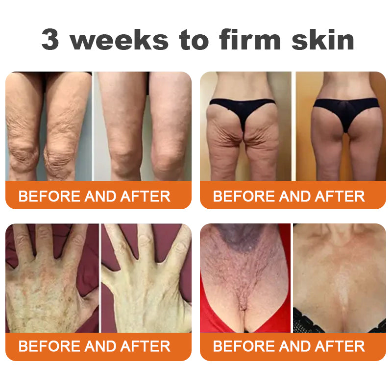 đđFlysmusâą Botox Bee Venom Firming Serum Stick â (Hergestellt und versendet in Germany) â LETZTER TAG 70 % RABATT