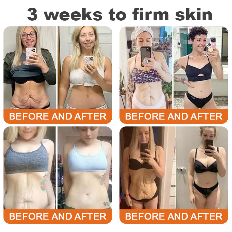 đđFlysmusâą Botox Bee Venom Firming Serum Stick â (Hergestellt und versendet in Germany) â LETZTER TAG 70 % RABATT