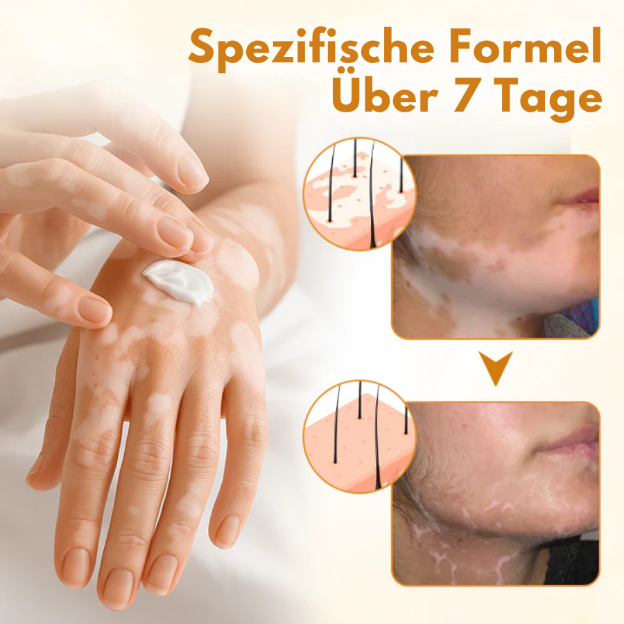 Fivfivgo® VitiCalm Bienengift-Creme,✔️95% Sichtbare Verbesserung In 4 Wochen ,Fördert Pigmentierung & Stellt Natürlichen Hautton Wieder Her