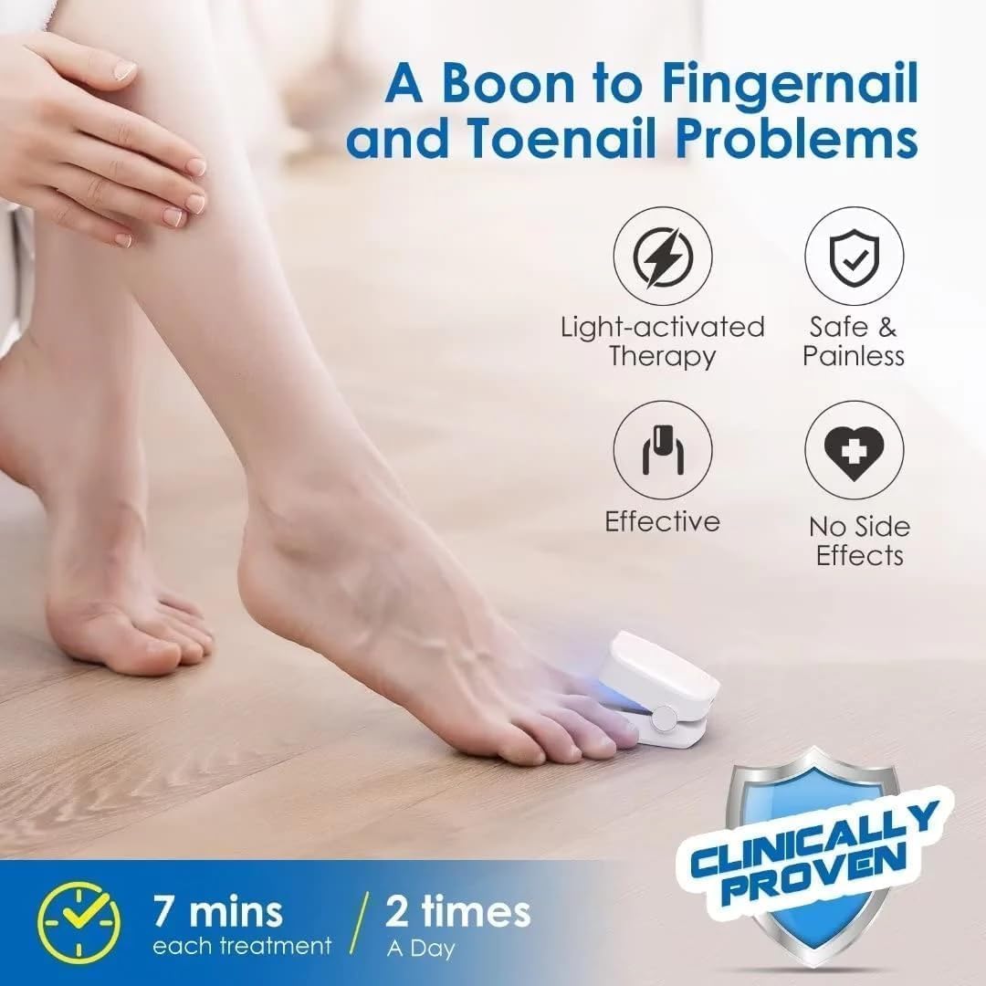Revolutionäres, hocheffizientes Lichttherapiegerät für Zehennagelerkrankungen, Lichttherapie bei Nagelpilz, Nagelreinigung und -pflege (1 Stück)