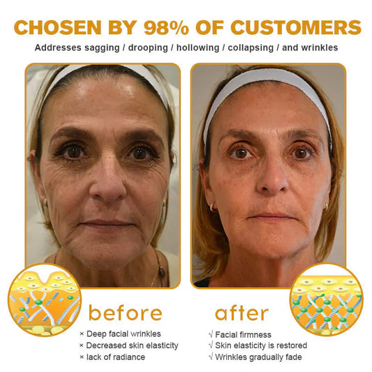 👨‍⚕️ Hergestellt und versendet in den DE ✅ Botox-Bienengift-Faltenentfernungscreme – LETZTER TAG 80 % RABATT
