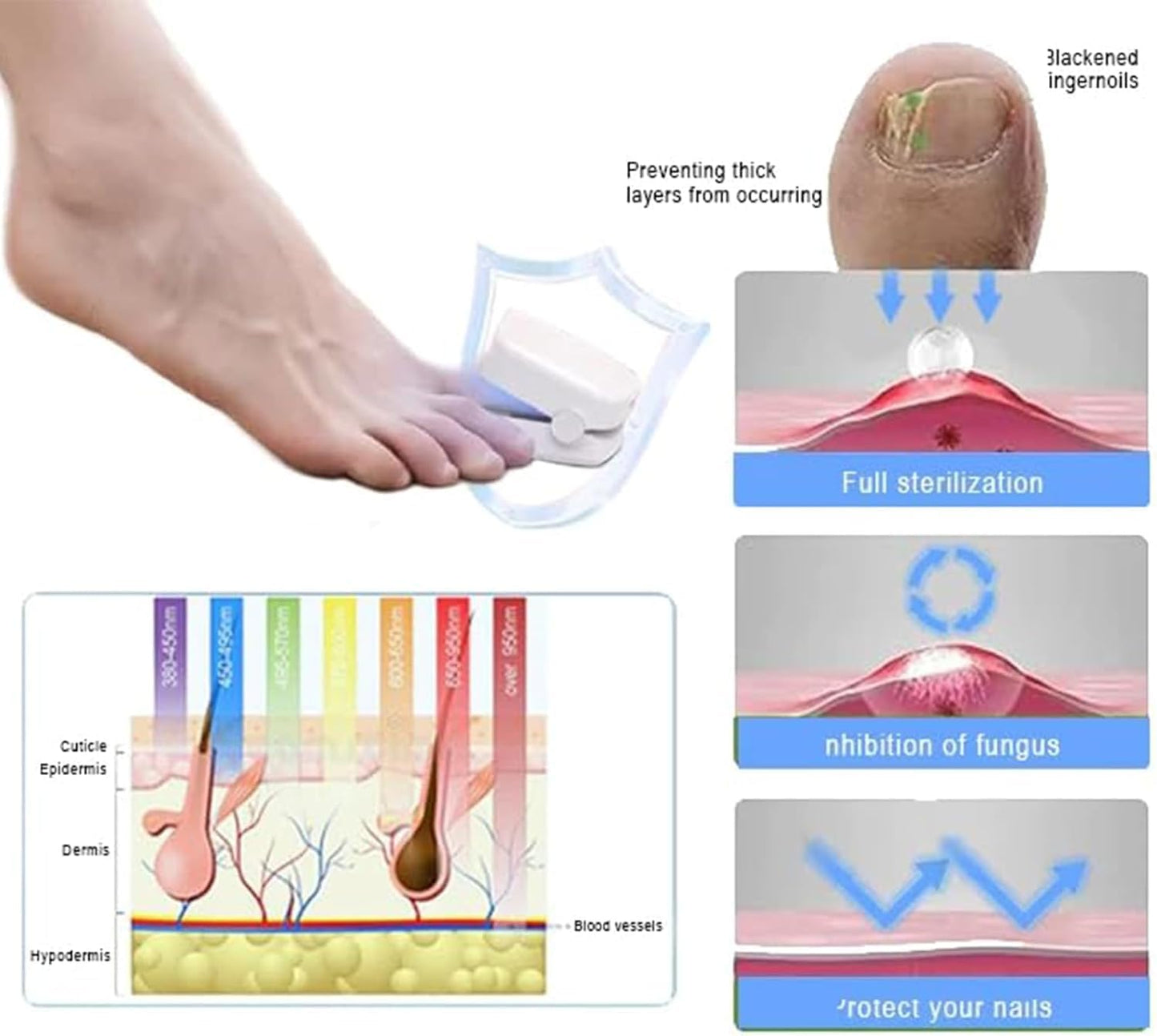 Revolutionäres, hocheffizientes Lichttherapiegerät für Zehennagelerkrankungen, Lichttherapie bei Nagelpilz, Nagelreinigung und -pflege (1 Stück)